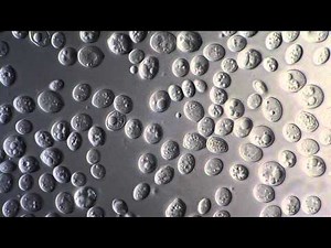 Yeast Saccharomyces Cerevisiae - DIC microscope 1000x