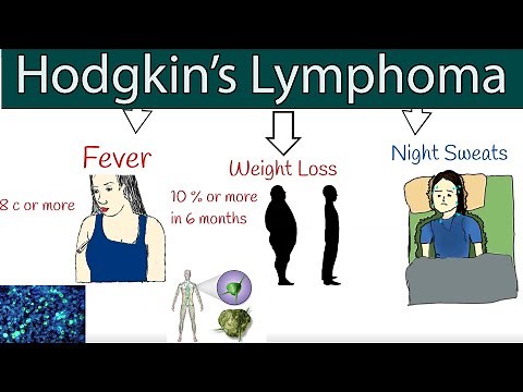 Hodgkin's lymphoma (Hodgkin's disease) - Symptoms and treatment. How to detect lymphoma?