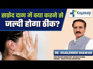 सफेद दाग का इलाज कितना समय लेता है? | Vitiligo में Results कब दिखते हैं? | Kayakalp Global