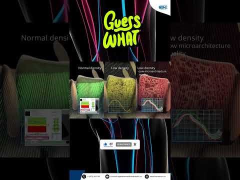 The Science of Echolight: How REMS Technology Measures Bone Quality