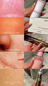 5 different skin concerns: 5 solutions ☺️🤍 #skincare101 #glowyskin #skintexture #bumpyskin #acne #acnecream #texturedskin #beauty #glassskingoals #hormonalacne | Song Of Skin