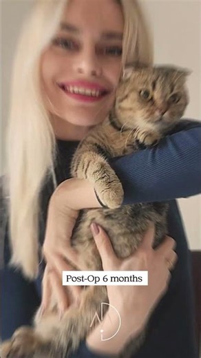 Temporal Lift • Fox Eyes • Rhinoplasty