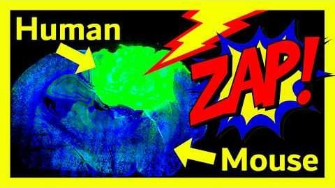 Cyborg Brain Implants: The Organoid Brain-Computer Interface (Human + Mouse + Computer) – Lifeboat News: The Blog