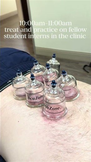 Term 9/10 SCU Student