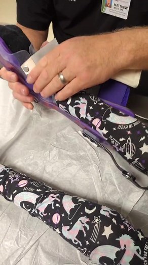 Ana's new KAFOs (Knee Ankle Foot Orthosis) #orthotist #legbraces #arthrogryposis | Team AMC Ana