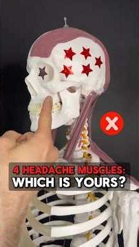 4 Headache Muscles: Which is Yours? Watch to Find Out! #headaches #headacherelief #headpain #muscles