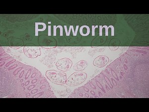 What is Pinworm? - Pathology mini tutorial