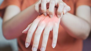 11 pictures of nasty bug bites to help YOU work out what bit you