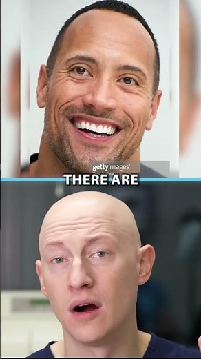 Dwayne 'The Rock' Johnson's Hair Loss | Plastic Surgeon Reacts