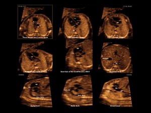 12_DIAGNOSTIC PLANES