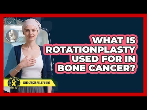 What Is Rotationplasty Used For In Bone Cancer? - Bone Cancer Relief Guide
