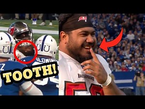 When Your Tooth Gets Knocked Out