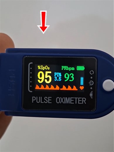 Pulsoxímetro u oxímetro de pulso Un equipo útil al momento de medir las funciones vitales. Te mostramos como usarlo y que valores podemos medir #enfermeria #pulsoxímetro #oximetrodepulso
