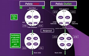 s2.09：patho PEC模式的治疗思路