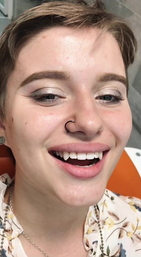 Кошачьи зубы человека - эксклюзивная работа