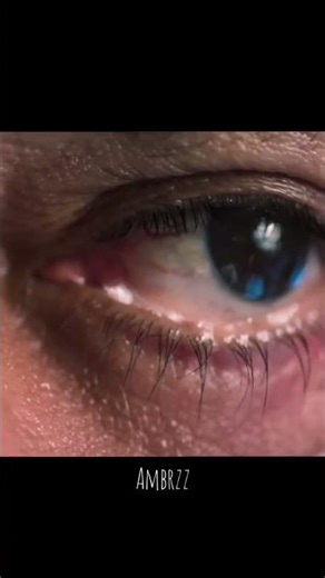 Sheriya kadilaki varana kombane thalachath🔥📈