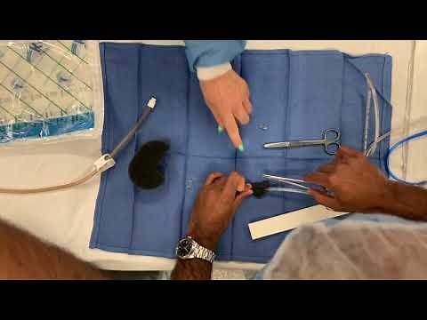 Endovac Instructional Video for esophageal perforation