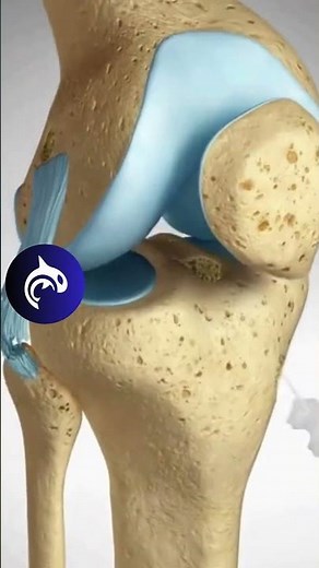 See an ACL LCL Tear & Surgical Repair in a 4K 3D animation.