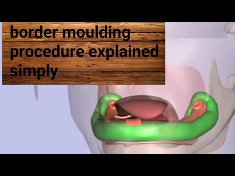 Border moulding procedure explained simply#dental prosthodontics #dental magic#border moulding