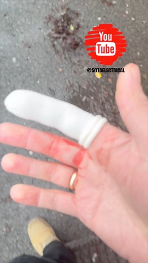 ELECTRICAL TAPE FAIL.. I NEEDED STITCHES #hospital #accident #electrician #electricians #electriciansoftiktok #electriciansofinstagram #electricianstools #electricianshit #electricianlife #electriciantools #sparky #sparkylife #electricianschool #electric #viral #howtotiktok #tools #toolstoday #skills | Sota Electrical Ltd