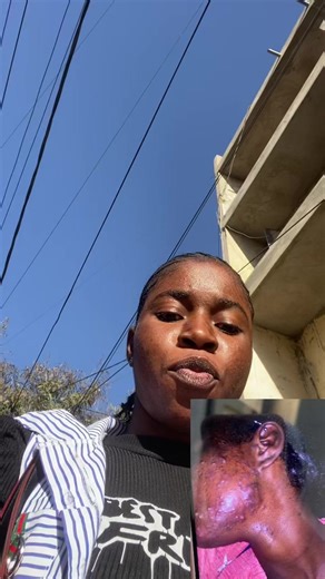 #edmark#cocollagen#secret de beauté #viral#videodebloque des vue