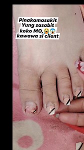 479 reactions · 14 shares | Ang sakit nasabit koko ni client Masakit...