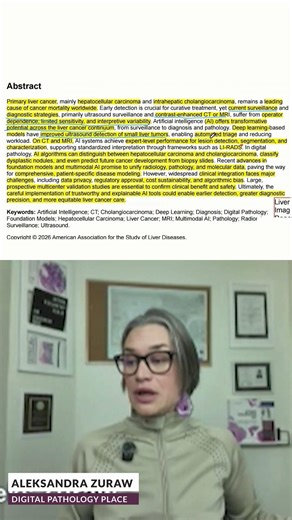 AI in Liver Cancer Diagnosis