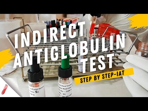 Indirect Coombs Test Procedure | Indirect Antiglobulin Test (IAT-Step by Step)