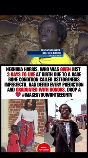 Doctors Gave Her 3 Days to Live—She Just Graduated with Honors ❤️🎓