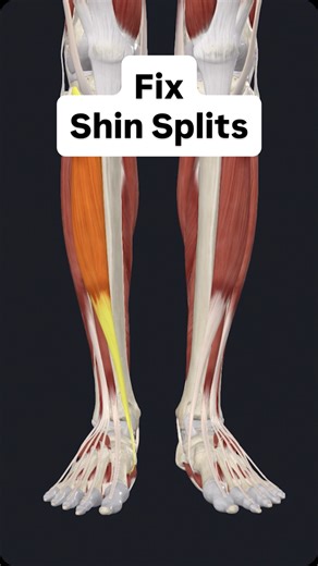 EMPOWER Health & Performance - OC Sports Chiropractor on Instagram: "Do shin splints have you sitting on the sidelines? Do these three exercises to get back in the game! #shinsplints #legpain #legpainrelief"