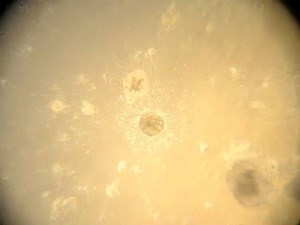 isolation-mammary-epithelial-cells-from-three-dimensional-mixed-cell