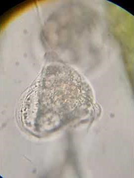 Vorticella Campanula (Protozoa) under microscope