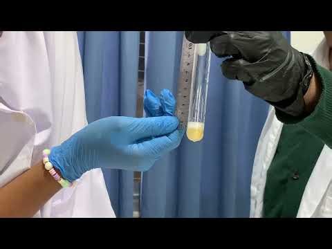 "Investigating Enzyme Action: The Effect of Temperature on Catalase Activity"