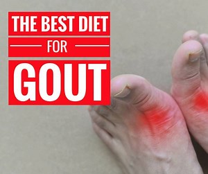 9.1K views · 114 reactions | Gout is a type inflammatory condition of the joints that can cause sudden and severe attacks of pain and swelling. Fortunately, gout can be controlled with medications, a gout-friendly diet and lifestyle changes. In this video i'm looking at what foods to eat and what to avoid for gout. | Diet vs Disease with Joe Leech - MSc Nutrition & Dietetics | Facebook