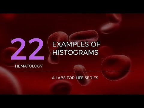 CBC Analyzer Part 6b - Examples of Histograms