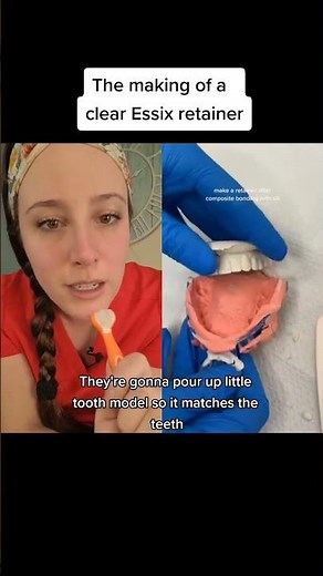 Retainer after bonding or braces: Essix retainers are made of clear plastic versus Hawley retainers