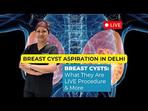Breast Cyst Aspiration in Delhi | Dr. Parul Garg Explains & Demonstrates the Procedure