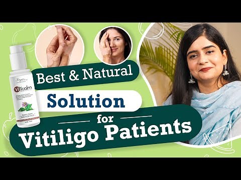 Use This Cream to Treat your Vitiligo Naturally | Best Cream for Vitiligo Patients