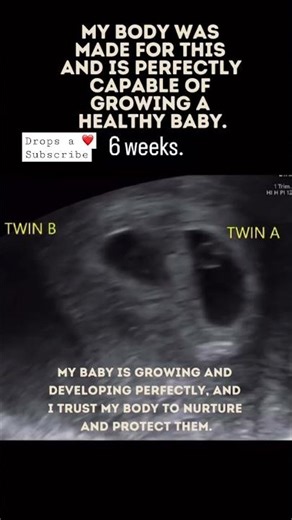Twins growing in the womb ||6 weeks To 12 weeks twins ultrasound #shorts #shortsfeed #twinsbaby