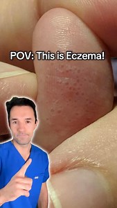 67K views · 2.4K reactions | Comment GUT1 to download GUT Health Guide #eczema #eczemarelief #skin | Hormonal Health | Facebook