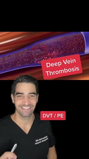 Understanding Blood Clots: Causes and Treatment Options