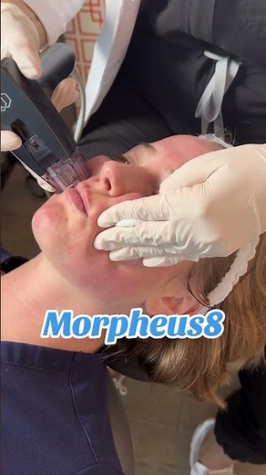 MORPHEUS8 Revolutionizes Skin TONE in 2024!
