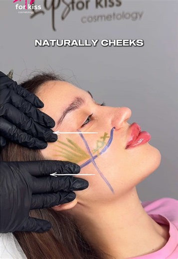 NEW VIDEO LESSONS AVAILABLE ➡️ Inst: lfk.academy 💉Start upgrading your knowledge right now and learn from the best 👉 Sign up now: www.LFK-academy.com #recommendations #cosmetology #skincare #fyp #fashion #estetik #lipfiller #jawline #fullface #botox #lifting #beauty #iconicLips #aestheticlips #lipenhancement #увеличениегуб #увеличениегубмосква #fullface #fullfaceмосква #fullfaceuk #lipfillersessex #lipaugumentation #коррекцияскул #lipfilleruk #коррекцияугловмосква #коррекцияскулмосква #лицопод