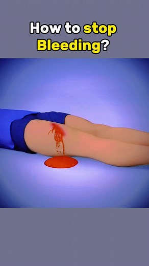 Stop Bleeding with Effective First Aid Techniques