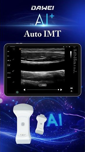 AI-powered Ultrasound Diagnostics | Carotid Artery IMT Measurement | Auto IMT