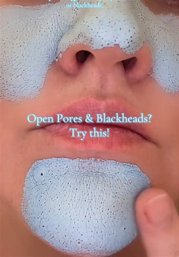 ✨ If you struggle with open pores or blackheads, this Medicube bundle is honestly one of the best combos I’ve tried. You get the Zero Pore Blackhead Cleansing Oil and the Zero Pore Mud Mask, and together they work so well for clearing out pores and making your skin feel properly clean. 🫧 Step 1 – Cleansing Oil This melts away makeup, SPF and all the buildup that sits in your pores throughout the day. It feels really lightweight but still deep cleans, and your skin feels super soft after rinsing
