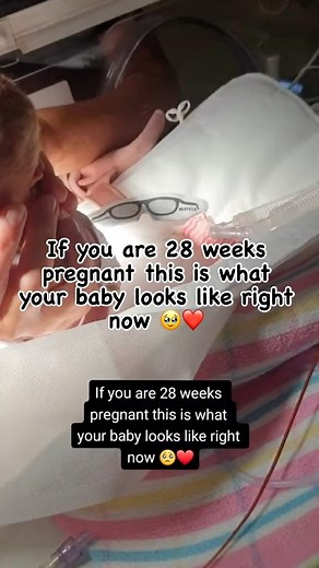 5.1K reactions · 276 shares | How much did your 28-week baby weigh at birth and now?  Masons Mum | OurLittlepreemie | Facebook