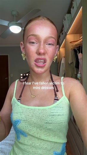 Stylish Green Mini Dress Outfit Inspiration