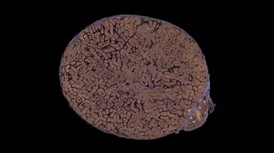 clip-1008987833-testis-spermatogenesis---cross-section-cut-under