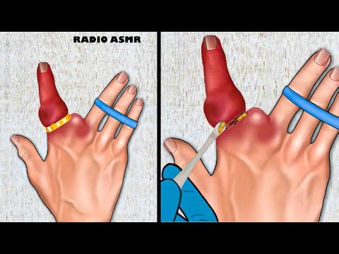 [ASMR ANIMATION] Removing Ring From the Hand / Helping Messi